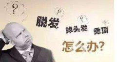 脫發(fā)怎么辦？鄭州植發(fā)醫(yī)院信息介紹？