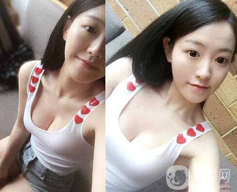 假體隆胸有什么危害？