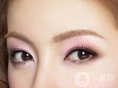 開(kāi)外眼角術(shù)前注意事項(xiàng)介紹
