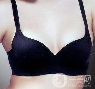 副乳切除術(shù)創(chuàng)口多大？