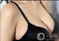 假體隆胸手術做完之后恢復期要多久時間？