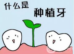 上海九院做一次種植牙價格是多少？價格貴嗎？