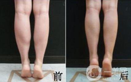 *的副作用有哪些？