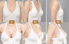 自體隆胸后多久可以上班？術(shù)后有哪些注意事項(xiàng)