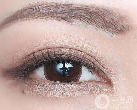 割雙眼皮術(shù)后注意事項(xiàng)有哪些？