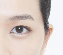 什么人適合開眼角？開眼角適宜人群有哪些？