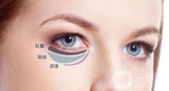 內(nèi)切祛眼袋術(shù)后護(hù)理主要有哪幾點(diǎn)？