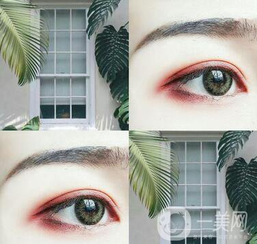 埋線雙眼皮要拆線嗎？如何護(hù)理？