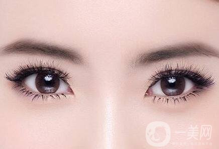 埋線雙眼皮術后護理有哪些？