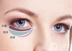 內(nèi)切眼袋真實恢復(fù)過程，術(shù)后注意事項