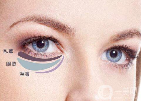 內(nèi)切眼袋真實(shí)恢復(fù)過(guò)程，術(shù)后注意事項(xiàng)