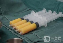 自體脂肪隆胸后多久可以恢復上班？