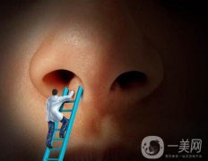 怎么縮小鼻翼？縮小鼻翼術(shù)后護(hù)理