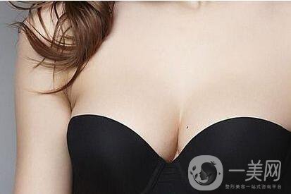 做乳暈飄紅,多久恢復(fù),術(shù)后護(hù)理