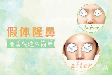 硅膠隆鼻可以維持一生嗎？