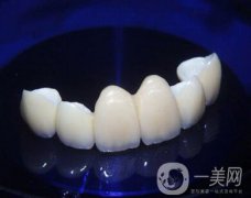 金鈀合金烤瓷牙價格多少錢？