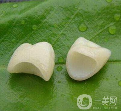 金鈀合金烤瓷牙價(jià)格多少錢？