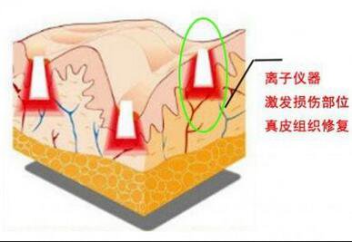 上海做一次像素激光去疤痕手術(shù)調(diào)節(jié)多少錢(qián)