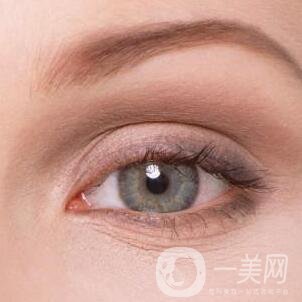 開(kāi)眼角割雙眼皮整形手術(shù)*果怎么樣