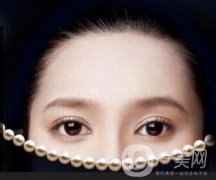 全切雙眼皮恢復過程一般是怎樣的 要注意些什么