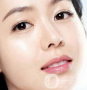 開(kāi)內(nèi)眼角多久恢復(fù)自然？