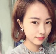 雙眼皮手術(shù)拆線后要怎樣護(hù)理
