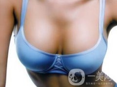 硅膠隆胸能管多久？隆胸手術(shù)具體費(fèi)用