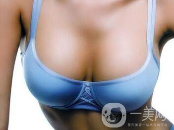 硅膠隆胸能管多久？隆胸手術(shù)具體費(fèi)用