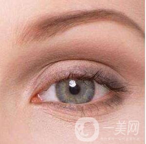 割雙眼皮,割雙眼皮恢復時間