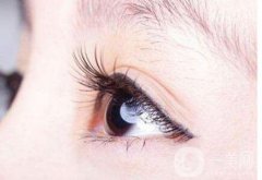 開眼角增生怎么修復(fù) 修復(fù)費用是多少
