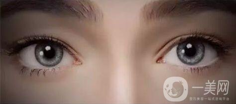 割雙眼皮,割雙眼皮多少錢(qián),武漢割雙眼皮多少錢(qián)