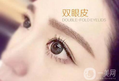 割雙眼皮,割雙眼皮多少錢(qián),武漢割雙眼皮多少錢(qián)