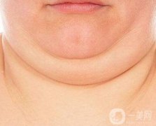 有雙下巴了怎么辦呢?去雙下巴的方法有哪些呢？