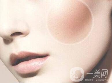 顴骨手術(shù)多長時間恢復(fù)？
