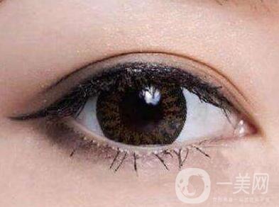 上海開眼角手術(shù)的費(fèi)用是多少？