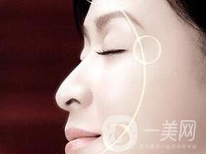 電波拉皮去除抬頭紋*果怎樣？