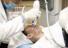 北京整形熱瑪吉拉皮價(jià)格要多少錢？
