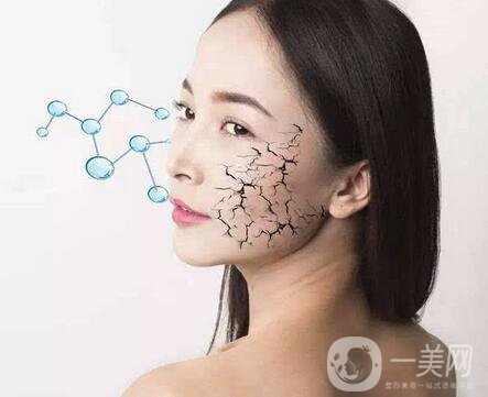 冰電波拉皮價格是多少？