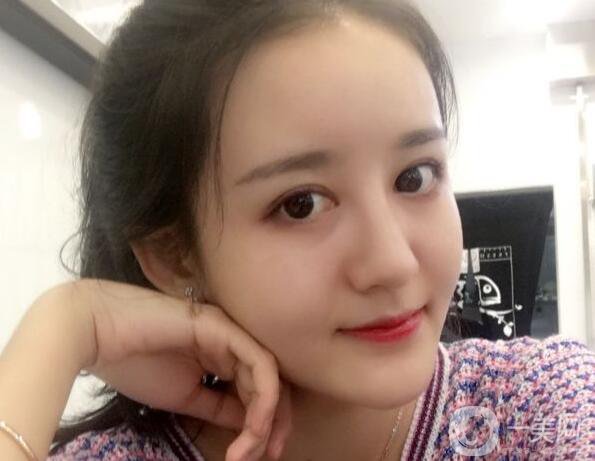 玻尿酸面部填充,玻尿酸面部填充術(shù)后護理