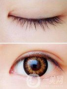 開(kāi)完眼角怎么預(yù)防增生？