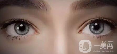 開完眼角怎么預(yù)防增生？