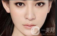 深圳膨體墊下巴價(jià)格是多少？果怎么樣？