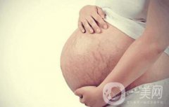 北京激光去妊娠紋價(jià)格一般是多少錢？