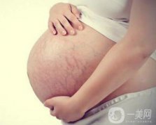 成都腹壁整形去妊娠紋多少錢呢？術(shù)后怎么護(hù)理？