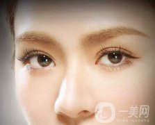 做了埋線多久能恢復(fù)自然？