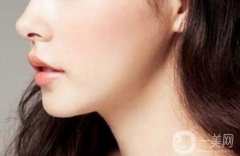 上海自體脂肪隆下巴費(fèi)用是多少?注意事項(xiàng)有哪些？