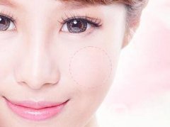 磨顴骨后遺癥有哪些？術(shù)后如何護(hù)理？