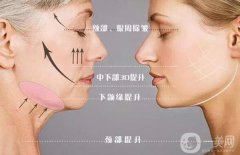 *的果到底如何呢?需要多少錢呢？