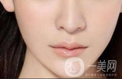 玻尿酸墊下巴會毀容嗎？注意事項有哪些？