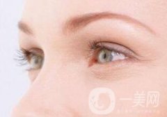 廣東玻尿酸去除魚尾紋多少錢？